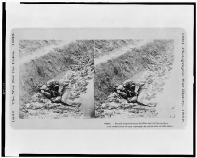 Thumbnail for 1911 - Dead Confederate soldier in the trenches